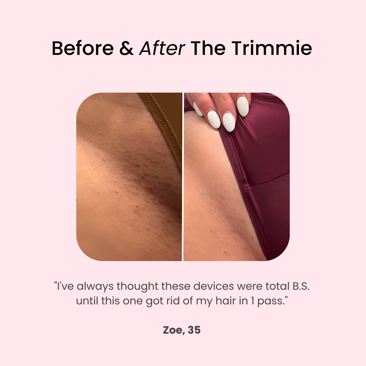The Trimmie 2.0 By Ezme
