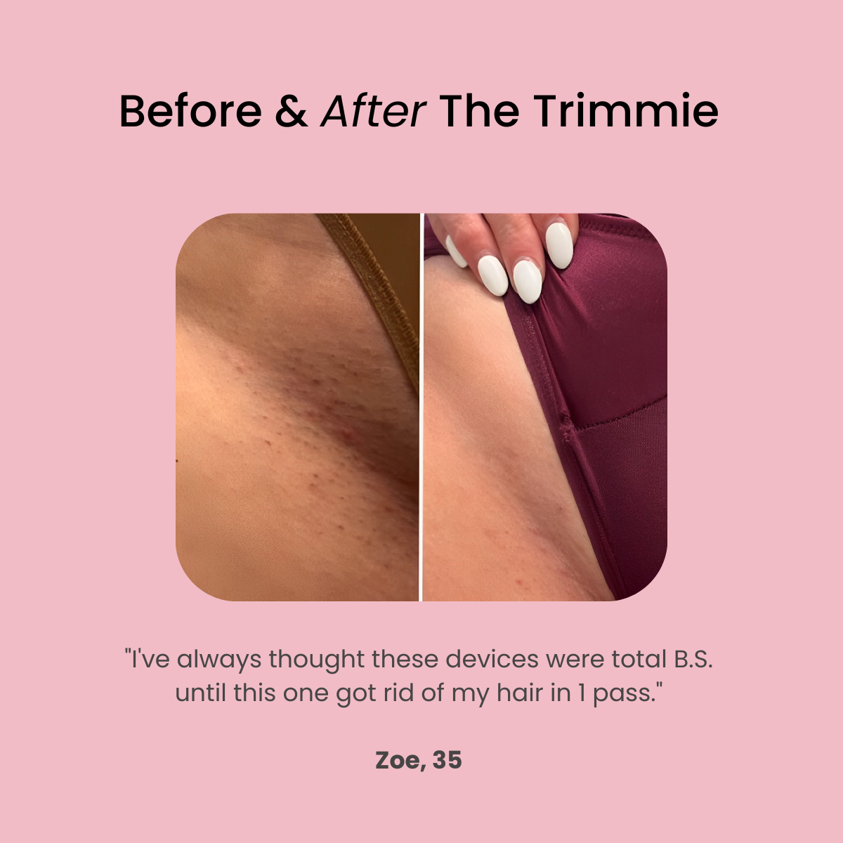 The Trimmie 2.0 By Ezme